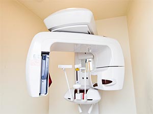 ベラビューエポックス3D（歯科用CT）